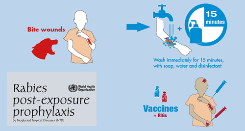 Rabies_pep_illustration Rabies post-exposure prophylaxis illustration