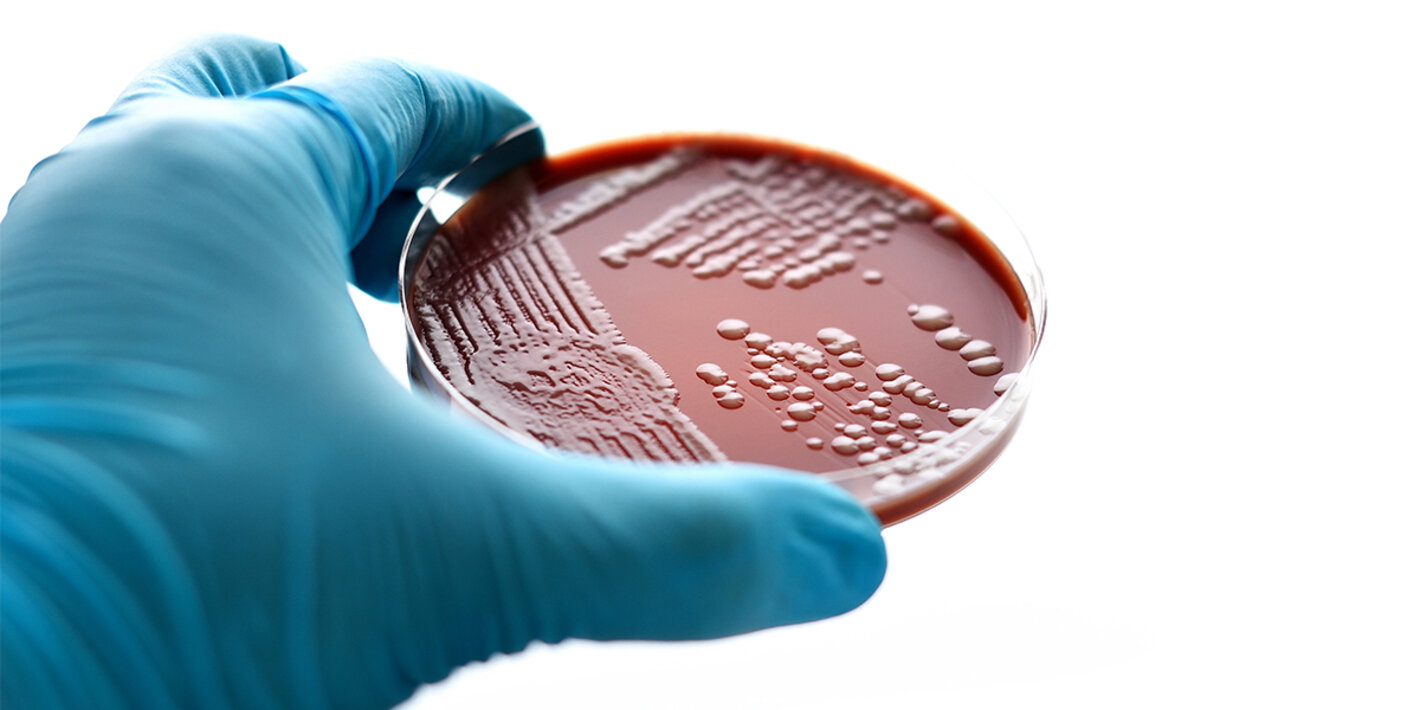 photo-gonorrea-2 Gonorrhoea, caused by Neisseria gonorrhoeae, is the second most common bacterial STI and results in substantial morbidity and economic cost worldwide.
